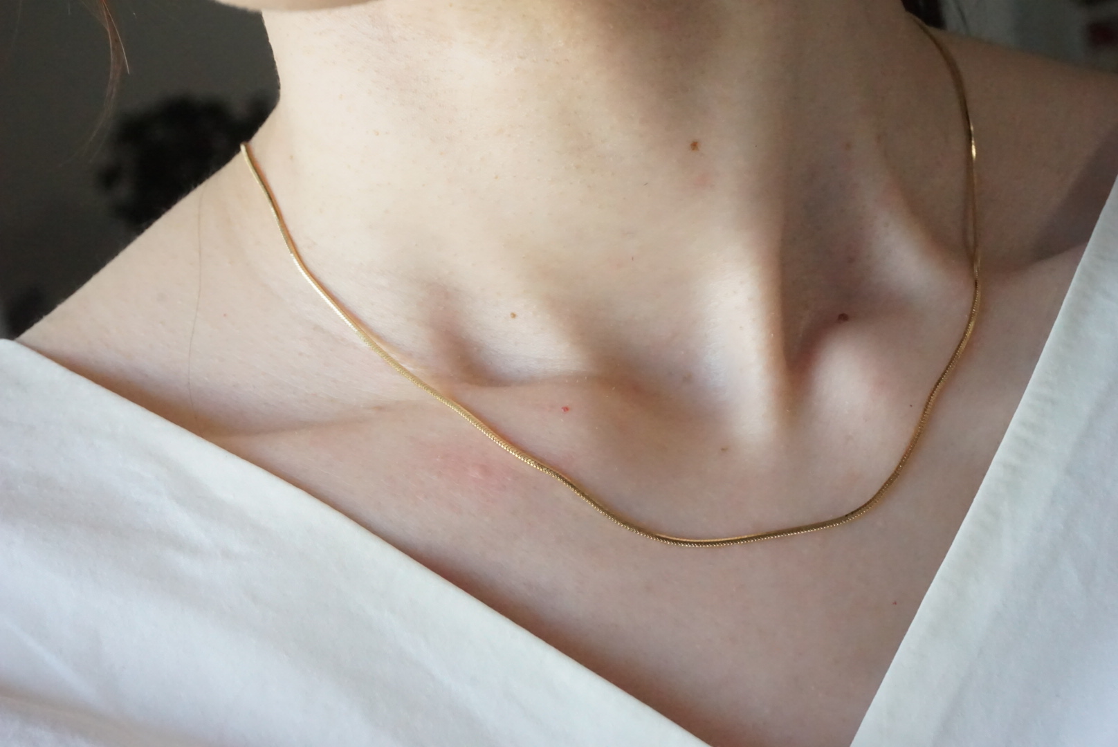 Snakechain choker(ゴールド)