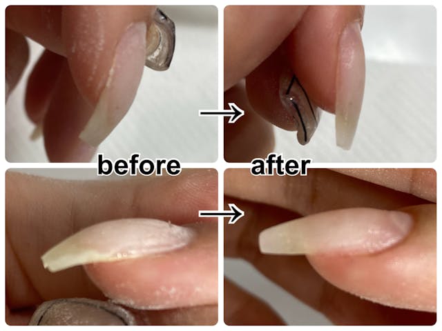 切らず、短時間、簡単！【鷲爪巻き爪矯正】のやり方