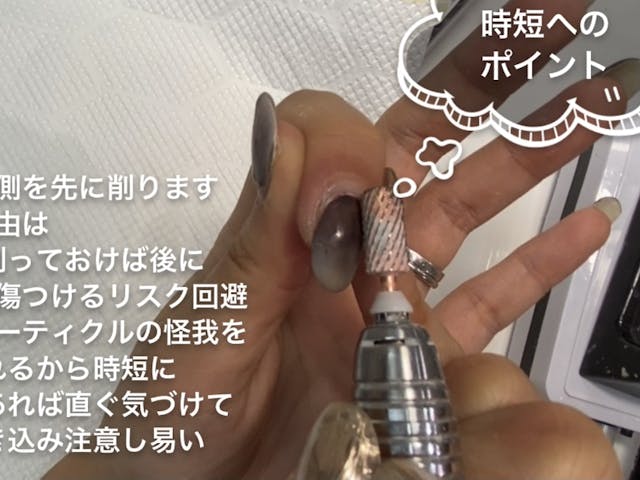 時短になる、フィルインとプレパレーション