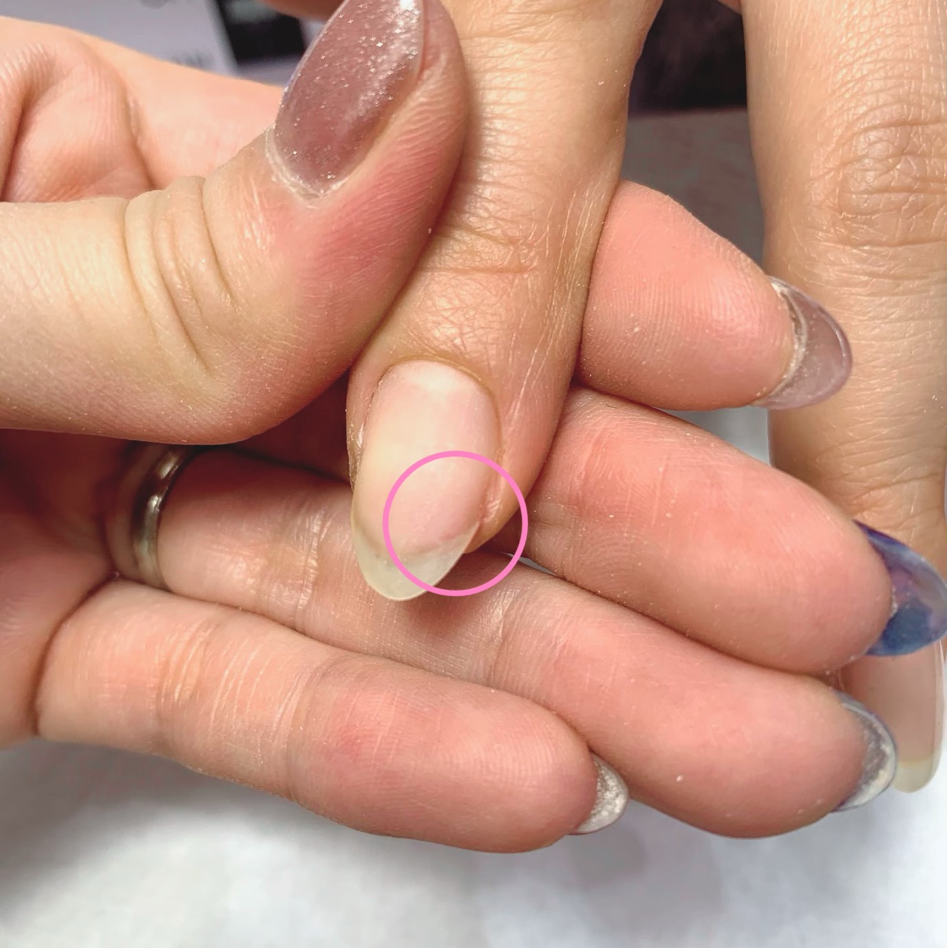 1ヵ月持つ亀裂補強の仕方（次回以降もそのままフィルイン）